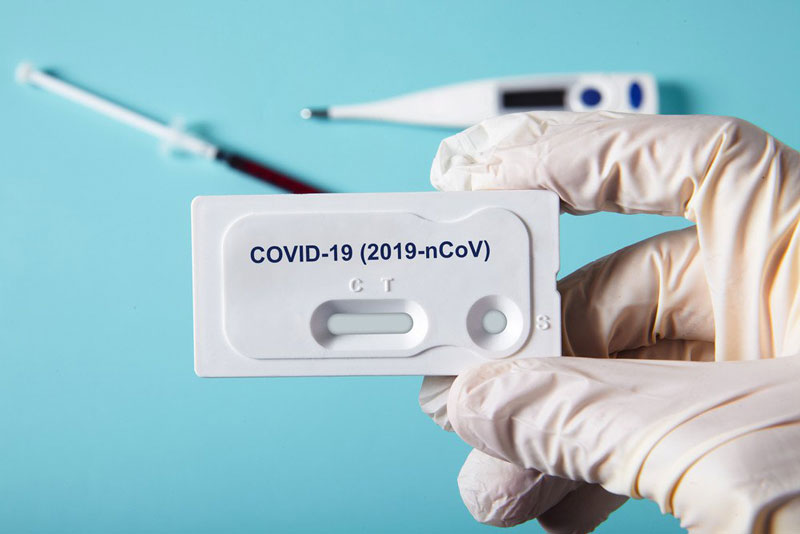 No hay pruebas rápidas de diagnóstico para coronavirus