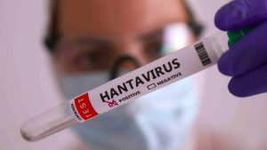 hantavirus